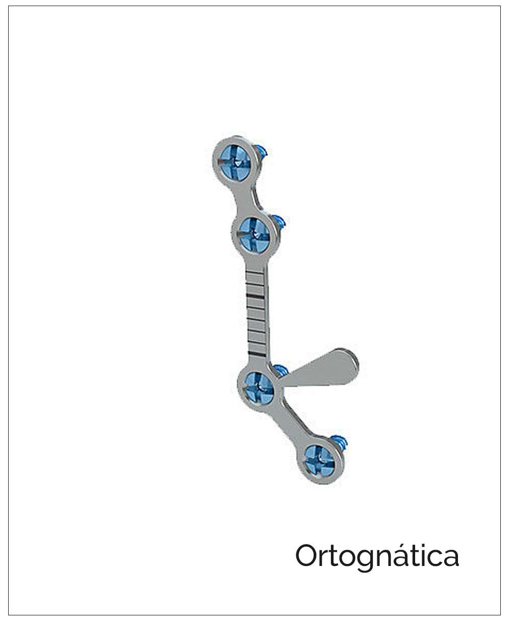 LevelOne Fixation System. Osteosynthesis