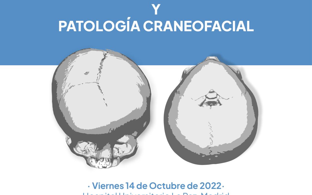 Curso teórico-práctico sobre Craneosinostosis y patología Craneofacial