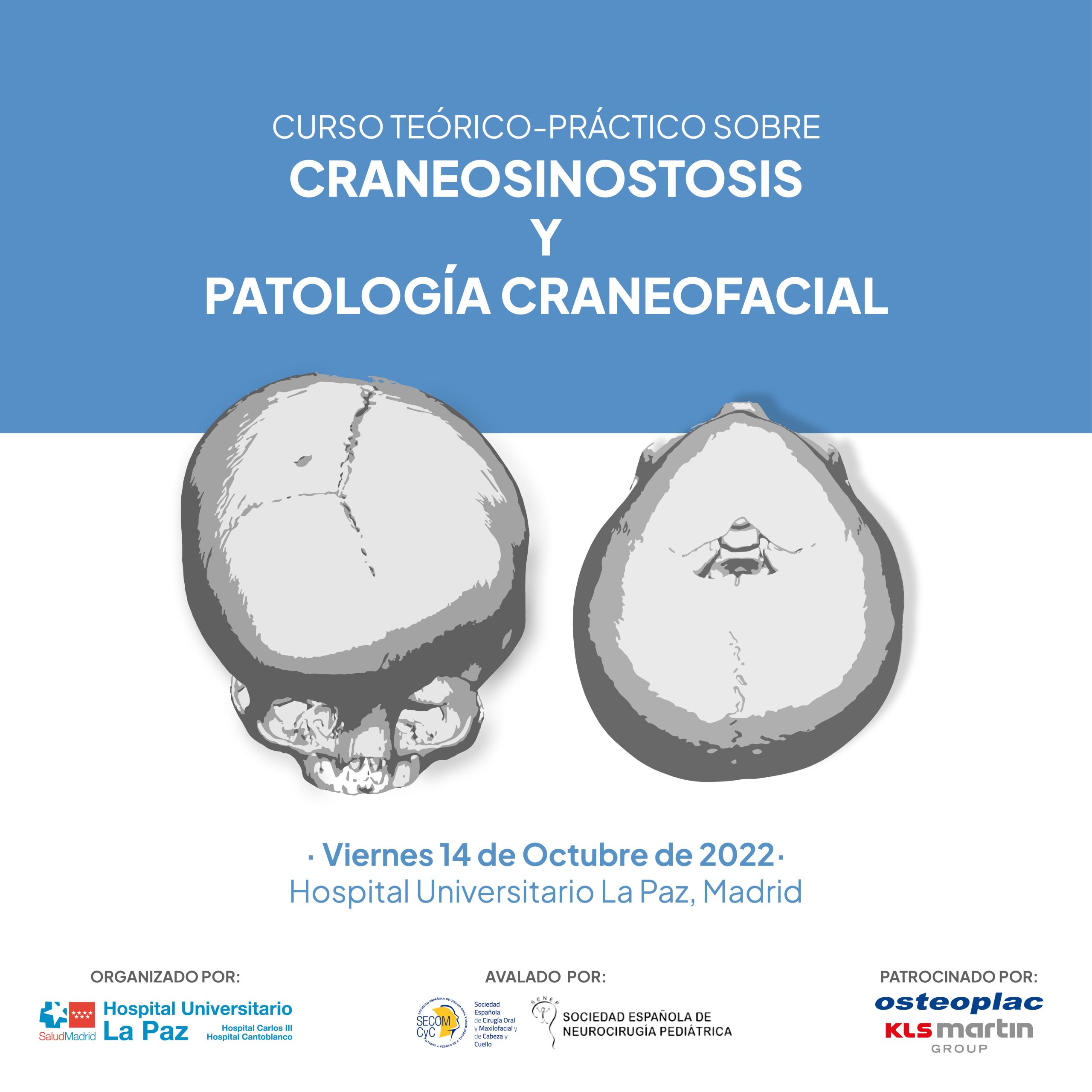 curso-teorico-practica-craneostosis-y-patologia-craneofacial-hospital-la-paz-madrid-14-de-octubre-2022