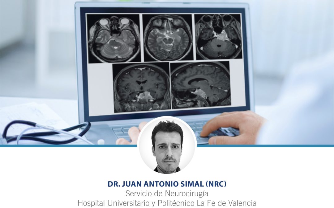 Webinar de la SEBAC impartido por el Dr. Juan Antonio Simal