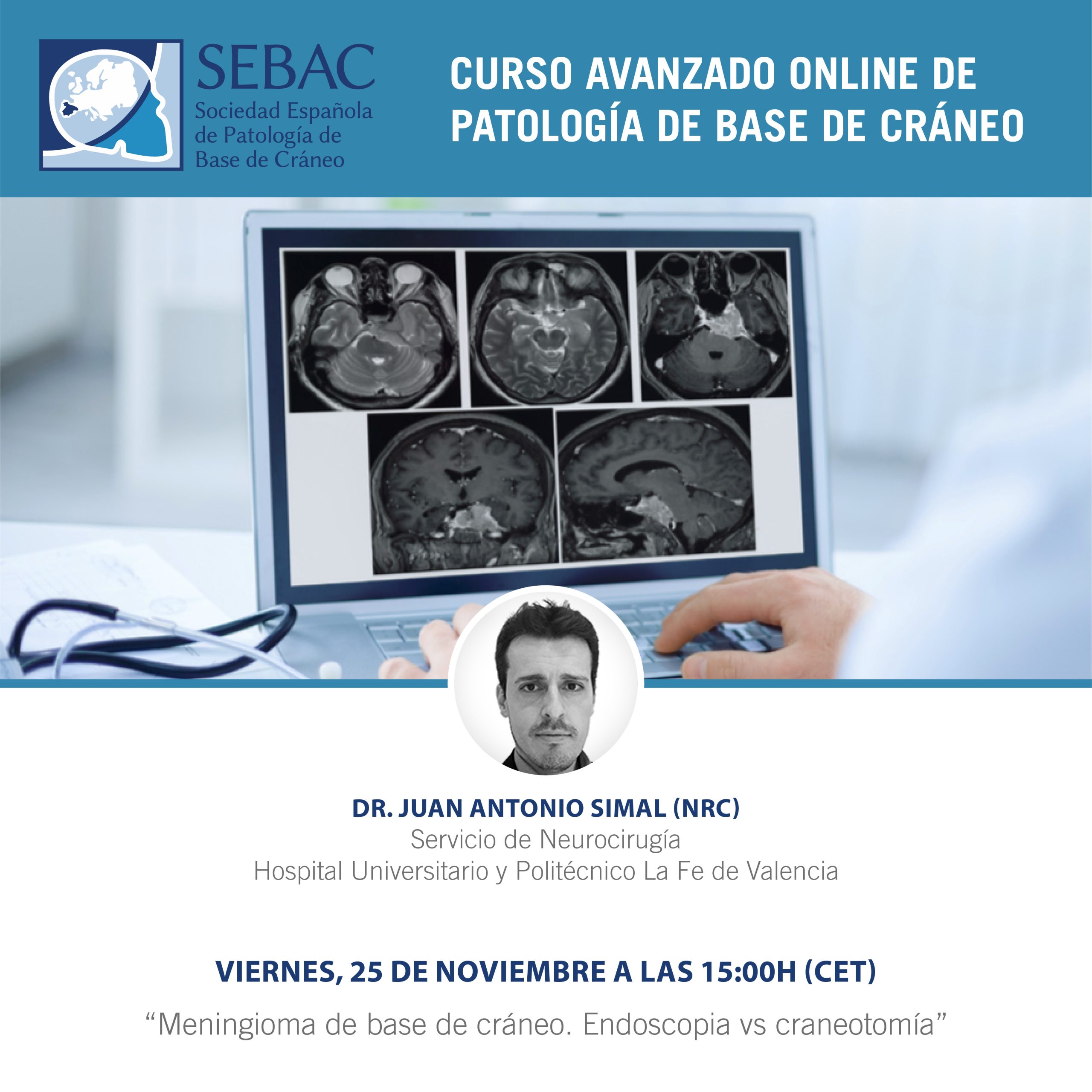 sebac-ponencia-simal