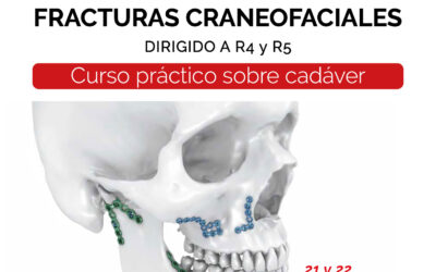 ¡Inscríbete en el Curso Avanzado de Cirugía Oral y Maxilofacial en el Campus de Bellvitge!