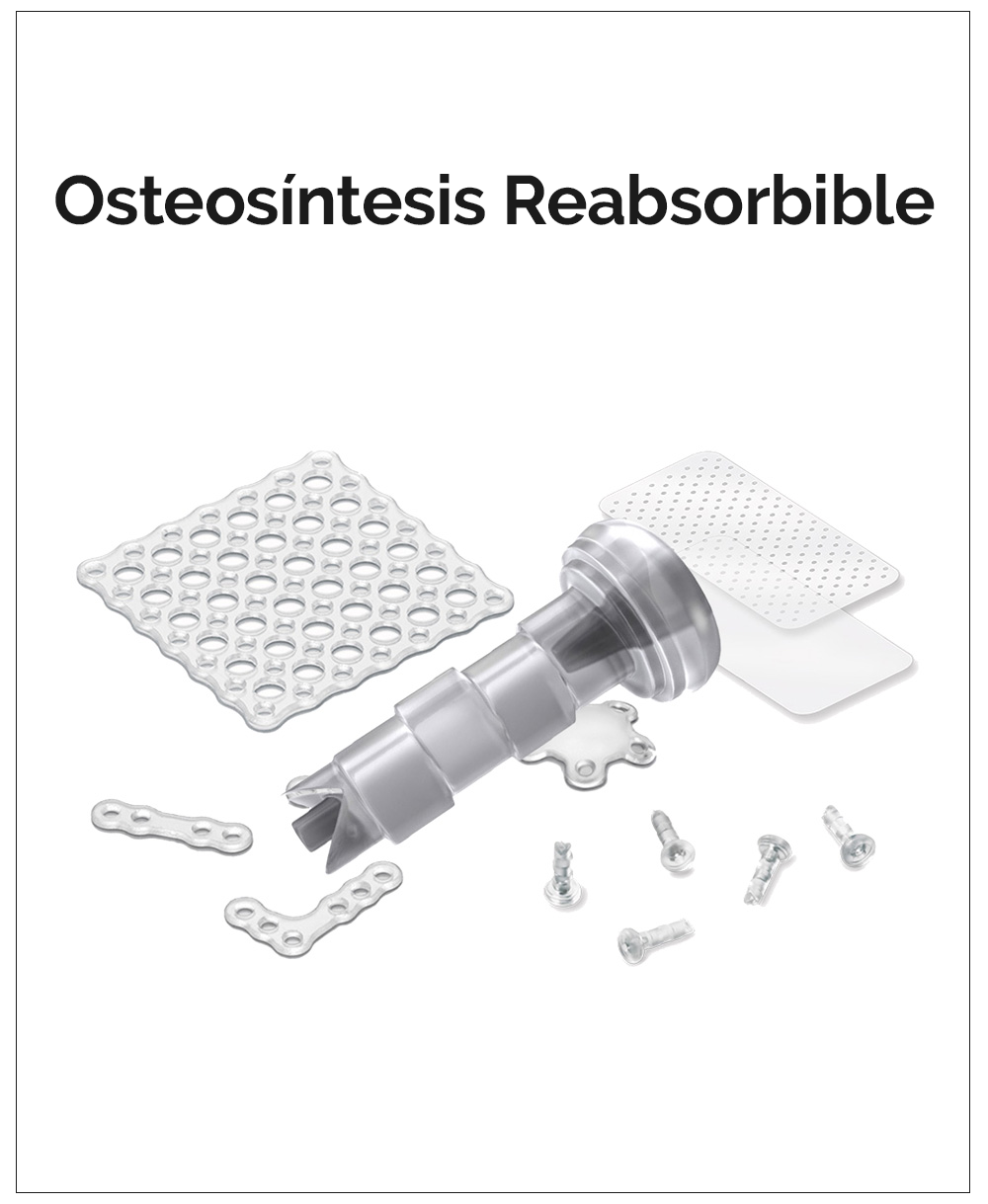 Osteosíntesis Reabsorbible