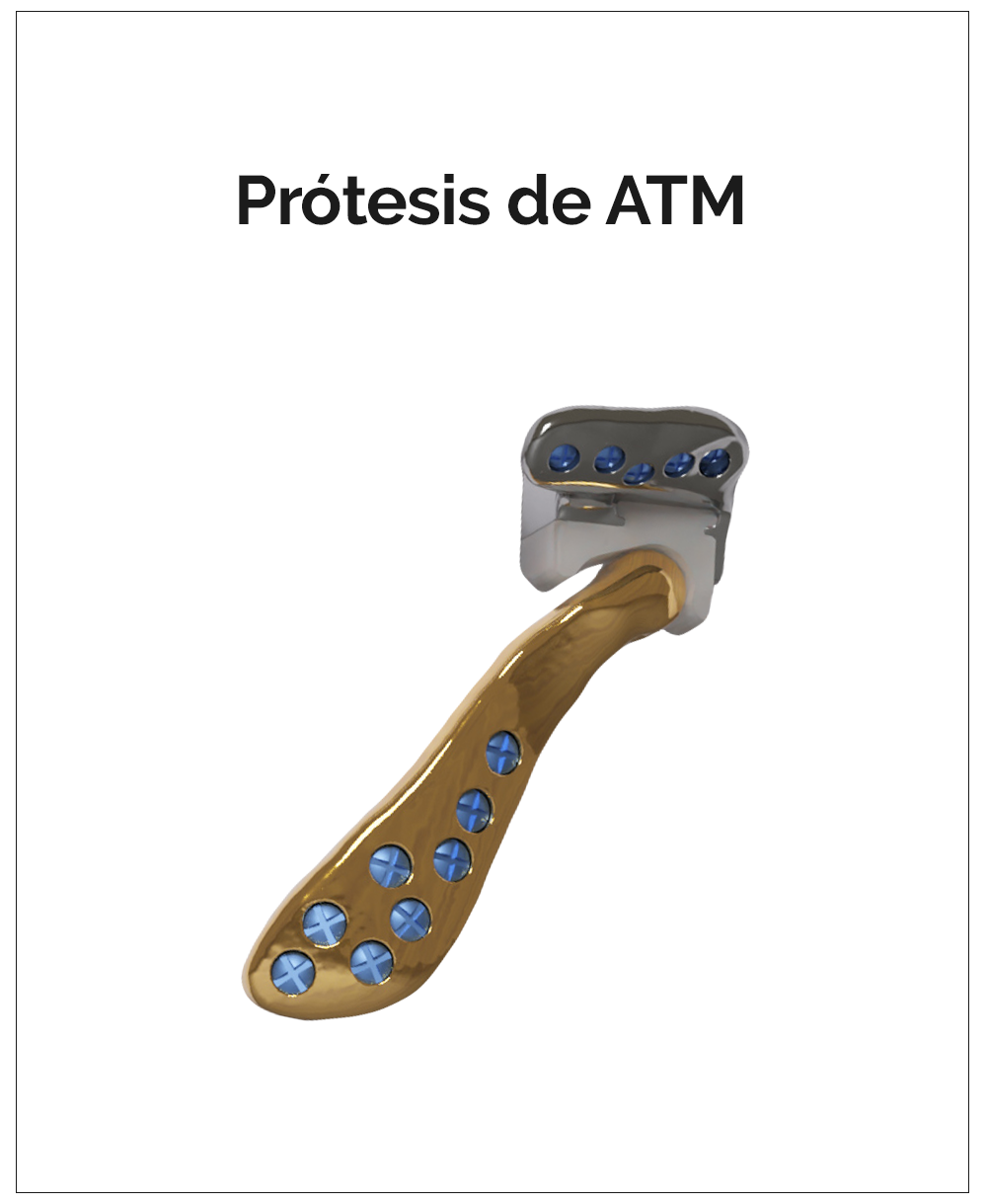 Prótesis de ATM